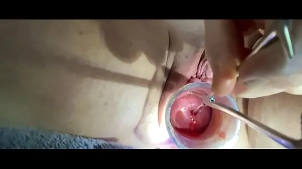 Big Sound tenaculum controlling uterus total Tube