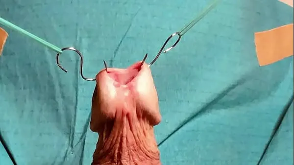Duża Opening urethra całkowita rura